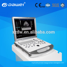 15" CE approved Digital Ultrasound Machine /scanner Portable Color Doppler with 3D / 4D